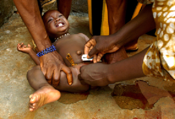 Non aux MGF au Niger