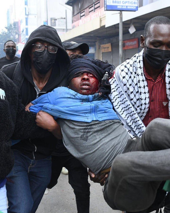 La mort d'un blogueur torturé en détention déclenche des manifestations massives et violentes au Kenya, mettant en lumière l'impunité